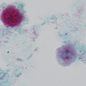 Case_503_D Figure D