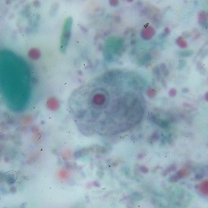 Case_503_F Figure F