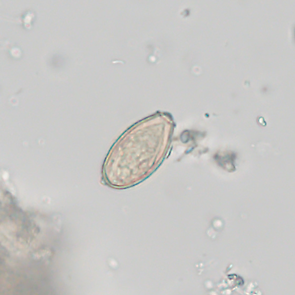 Case527_B Figure B