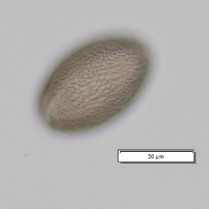 Case_509_B Figure B