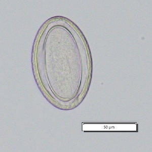 Case_509_D Figure A
