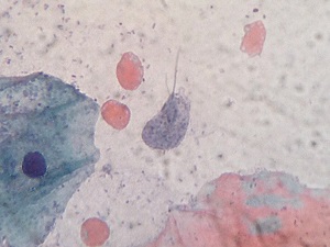 Case_512_B Figure B
