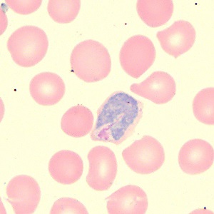 Case_515A Figure D