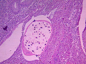 Case_517_B Figure B