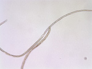 Case_518_B Figure B