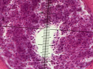Case_519_B Figure B
