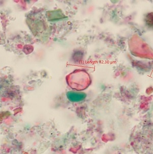Case_520_C Figure B