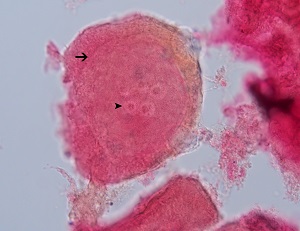 C2