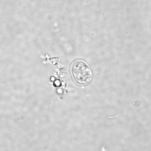 Enana_cyst_wtmt2.jpg Figure A