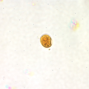 Enana_cyst_wtmt_lugols.jpg Figure B