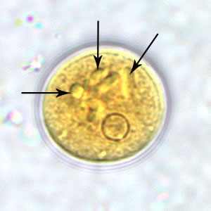 Epolecki_cyst_wtmt.jpg Figure A