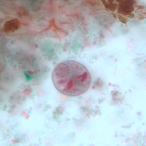 E_polecki_cyst1.jpg Figure E