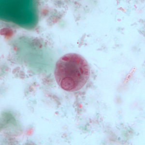 E_polecki_cyst2.jpg Figure F