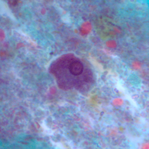Epolecki_troph_tric2.jpg Figure C