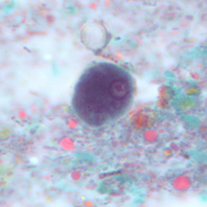 Epolecki_troph_tric4.jpg Figure E