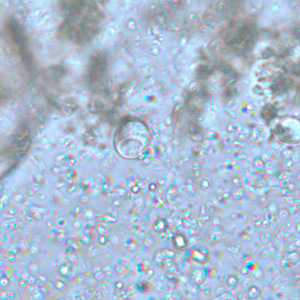 Iodamoeba_wtmt_BAM4.jpg Figure A