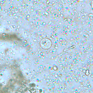 Iodamoeba_wtmt_BAM5.jpg Figure B