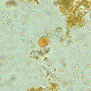 Iodamoeba_wtmt_iodine_BAM2.jpg Figure C