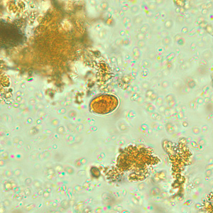 Iodamoeba_wtmt_iodine_BAM4.jpg Figure D