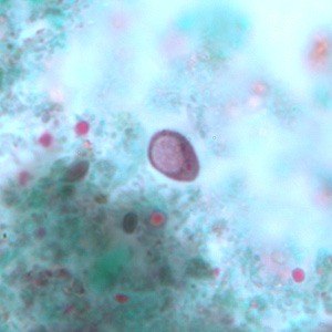 I_buetschlii_cyst_trich_BAM1.jpg Figure A