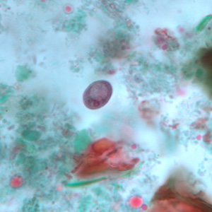 I_buetschlii_cyst_trich_BAM2.jpg Figure B