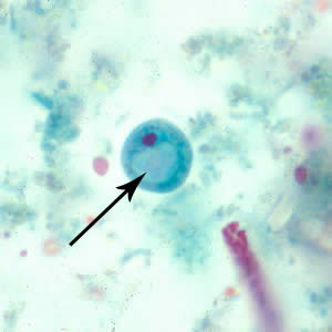 Ibuetschlii_cyst_tric.jpg Figure C