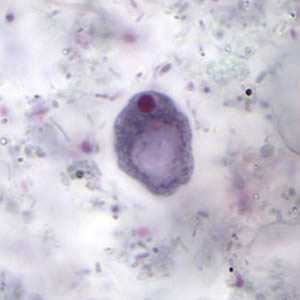 Ibuetschlii_cyst_tric2.jpg Figure D