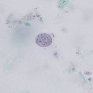 E_nana_cyst_trich_BAM1.jpg Figure B