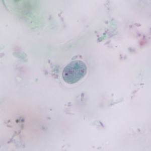 E_nana_cyst_trich_BAM2.jpg Figure C