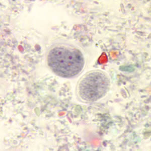 Enana_cyst_tric.jpg Figure A