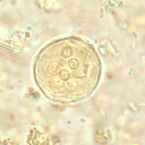 Ecoli_cyst_wtmt.jpg