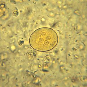 Ecoli_cyst_wtmt2.jpg