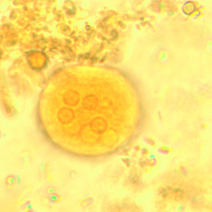 Ecoli_cyst_wtmt3.jpg