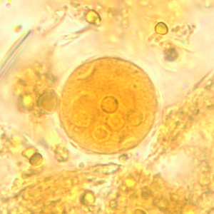 Ecoli_cyst_wtmt4.jpg