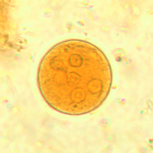 Ecoli_cyst_wtmt5.jpg