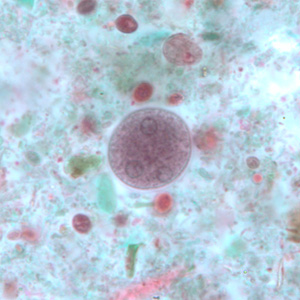 E_coli_cyst_BAM1a.jpg Figure E