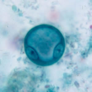Ecoli_cyst_tric.jpg Figure A