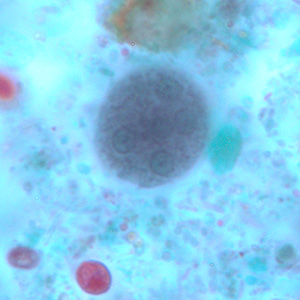 Ecoli_cyst_tric2.jpg Figure B