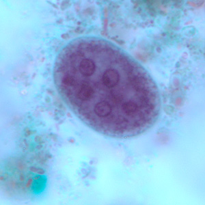 Ecoli_cyst_tric3.jpg Figure C