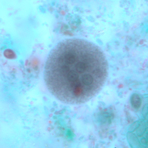 Ecoli_cyst_tric4.jpg Figure D