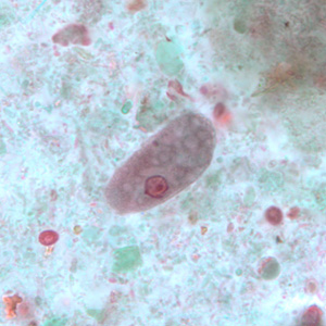 E_coli_troph_BAM1.jpg Figure D