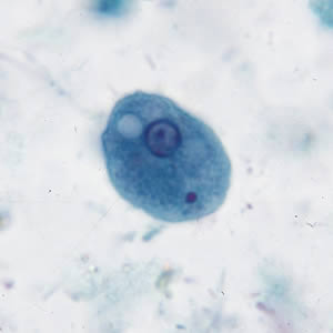 Ecoli_troph_tric.jpg Figure A