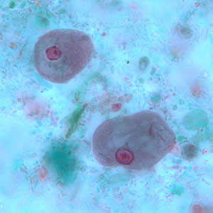 Ecoli_troph_tric3.jpg Figure C