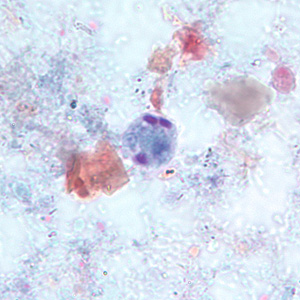 E_hartmanni_cyst_trich_BAM1.jpg Figure A