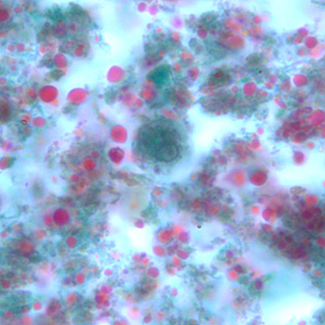 E_hartmanni_cyst_trich_BAM7.jpg Figure B