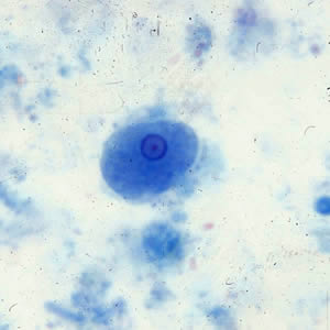 Ehartmanni_troph_tric3.jpg Figure B