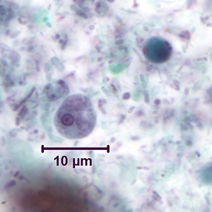 Ehartmanni_troph_tric4.jpg Figure C