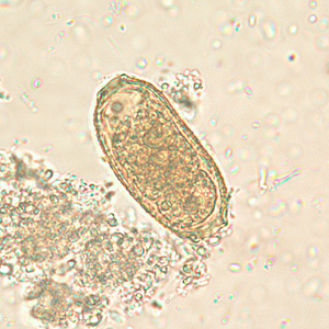 C_philippinensis_egg2.jpg Figure B