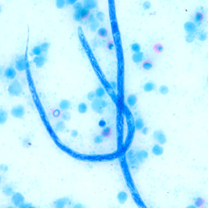 Loa_knotts_500x.jpg