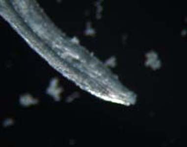 L_loa_adult_GA2.jpg